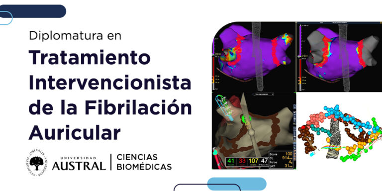 Fibrilación HEADER